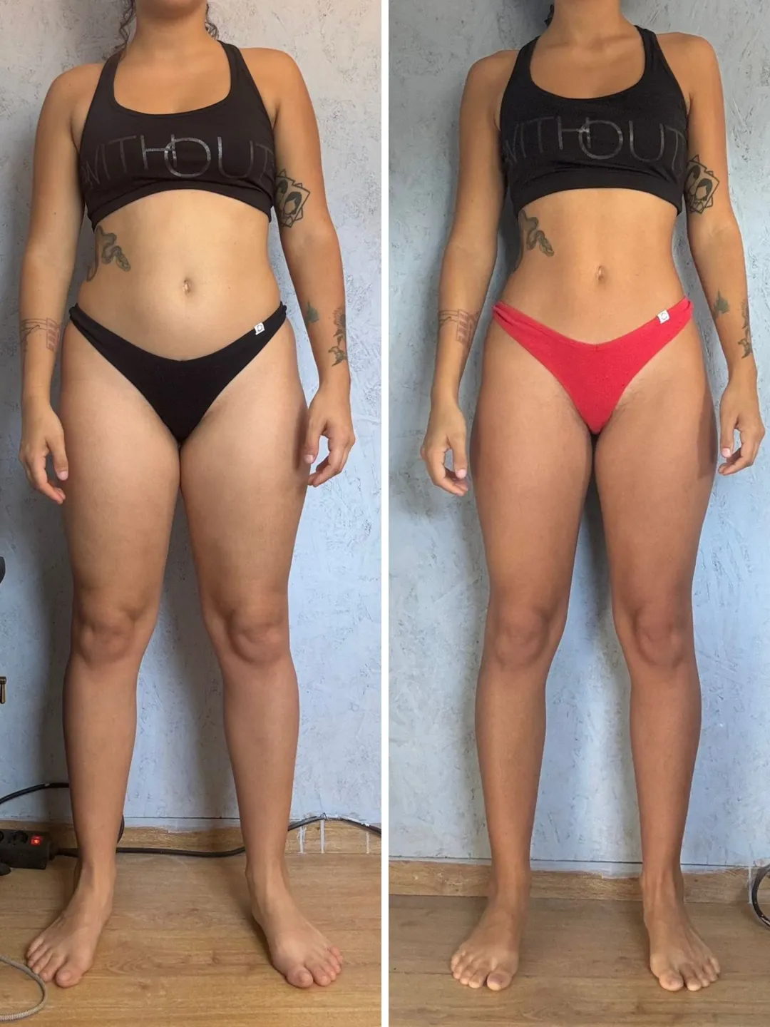 Antes e depois de Ana